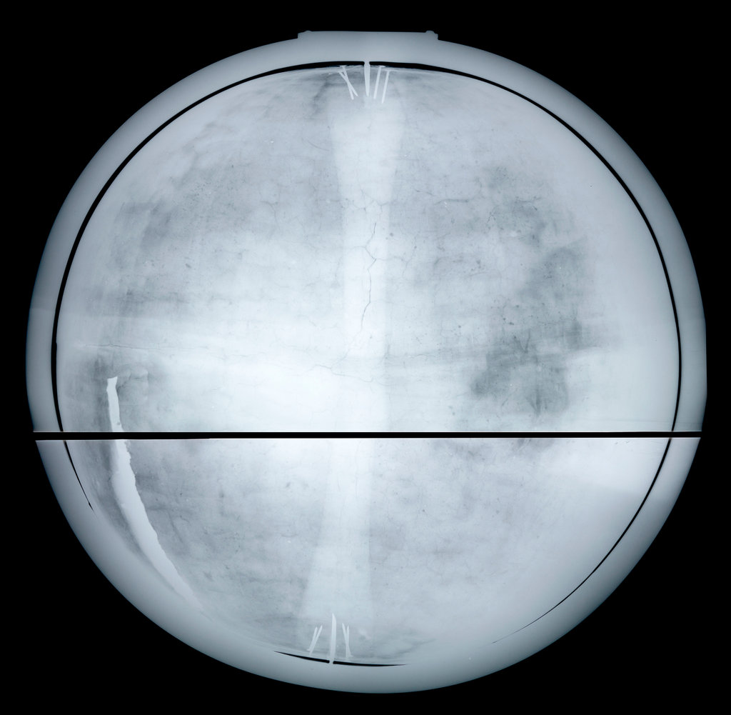 Globe x-ray